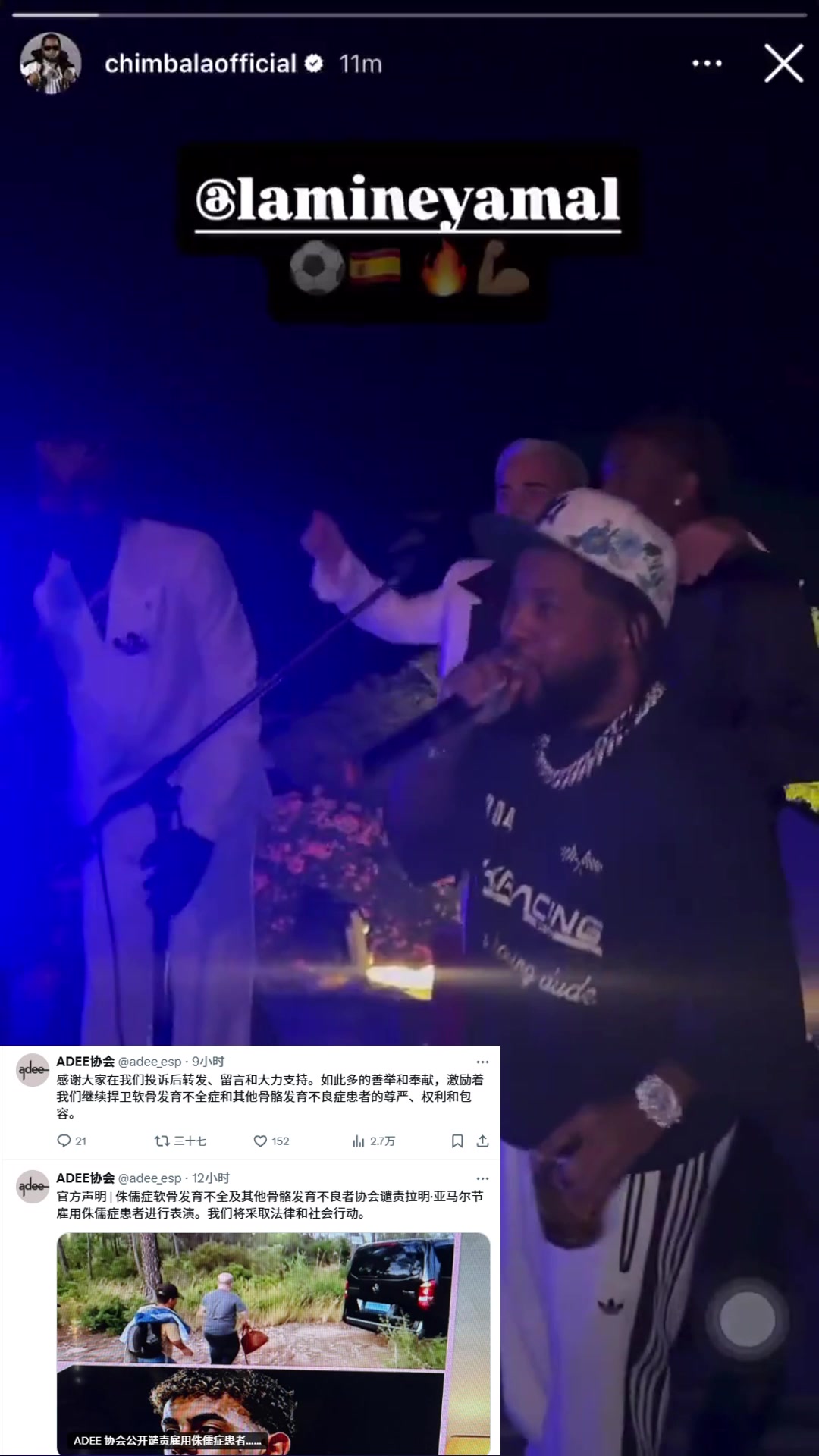 西班牙ADEE將起訴亞馬爾雇傭侏儒癥歌手譴責(zé)物化侏儒癥